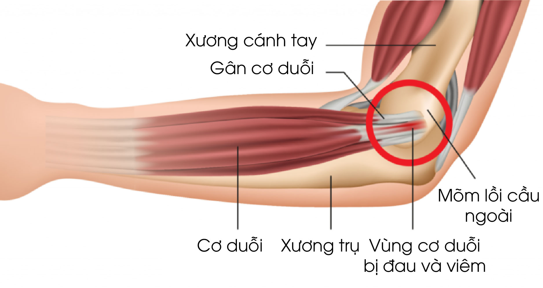 Căng cơ bắp tay căng cơ bắp tay