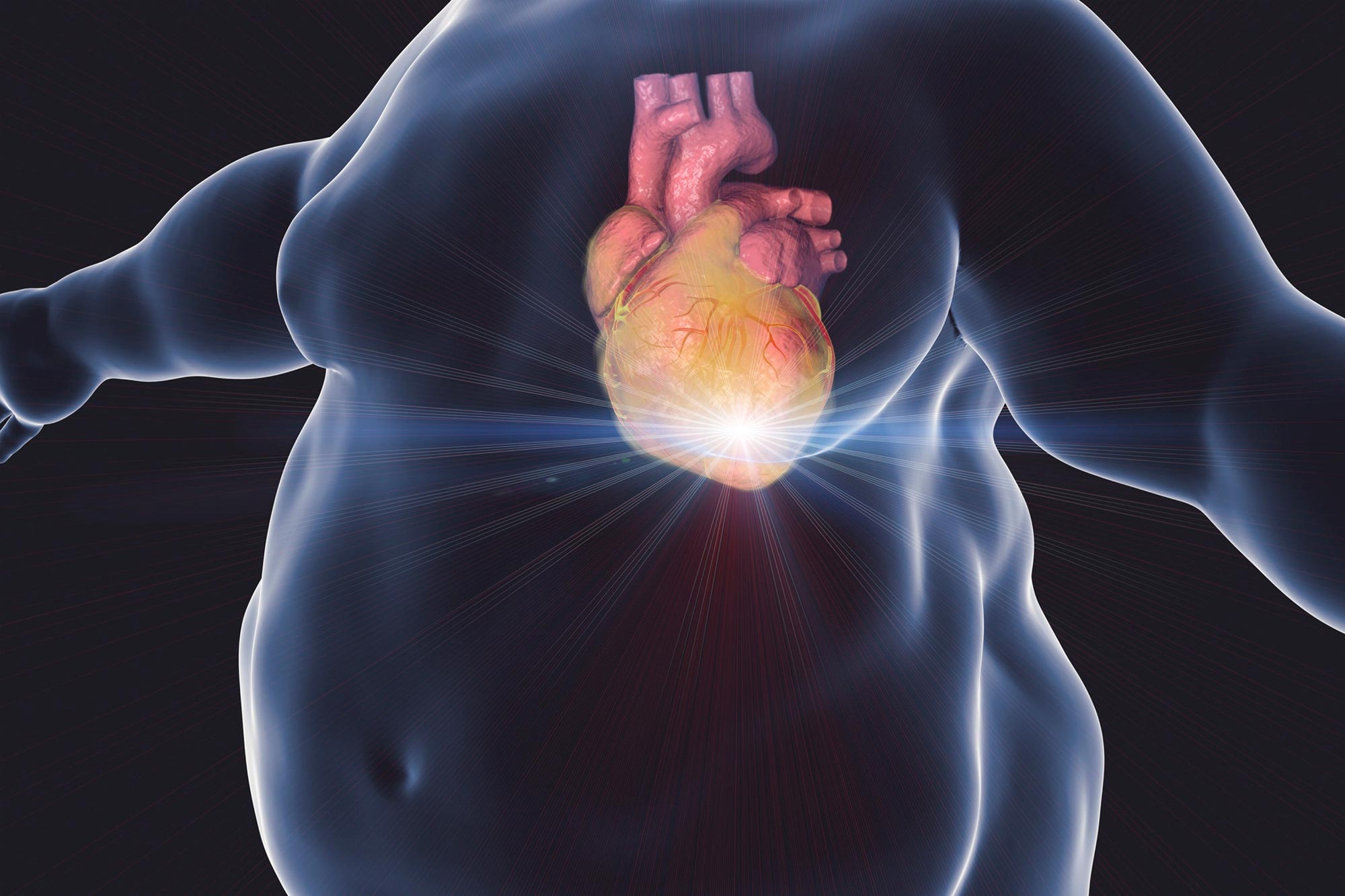 Ở những người bị béo phì, tim cần làm việc nhiều hơn để bơm máu đi khắp cơ thể, dẫn đến huyết áp cao