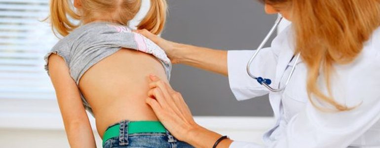 4 Biện Pháp Chống Cong Vẹo Cột Sống Cho Trẻ