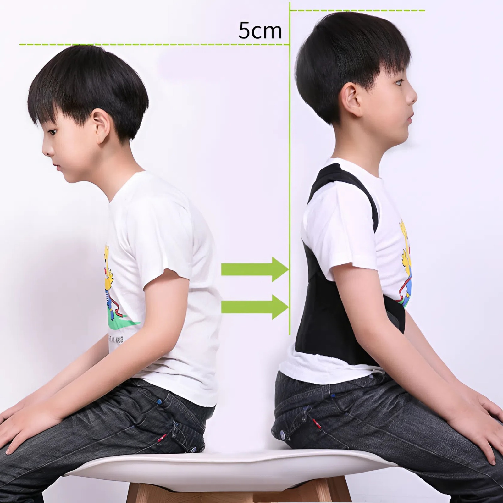 Gù tư thế khác gì với biến dạng cột sống? Gù tư thế khác gì với biến dạng cột sống?